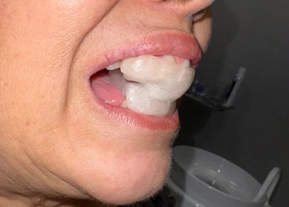 Imagem intraoral durante um atendimento odontológico