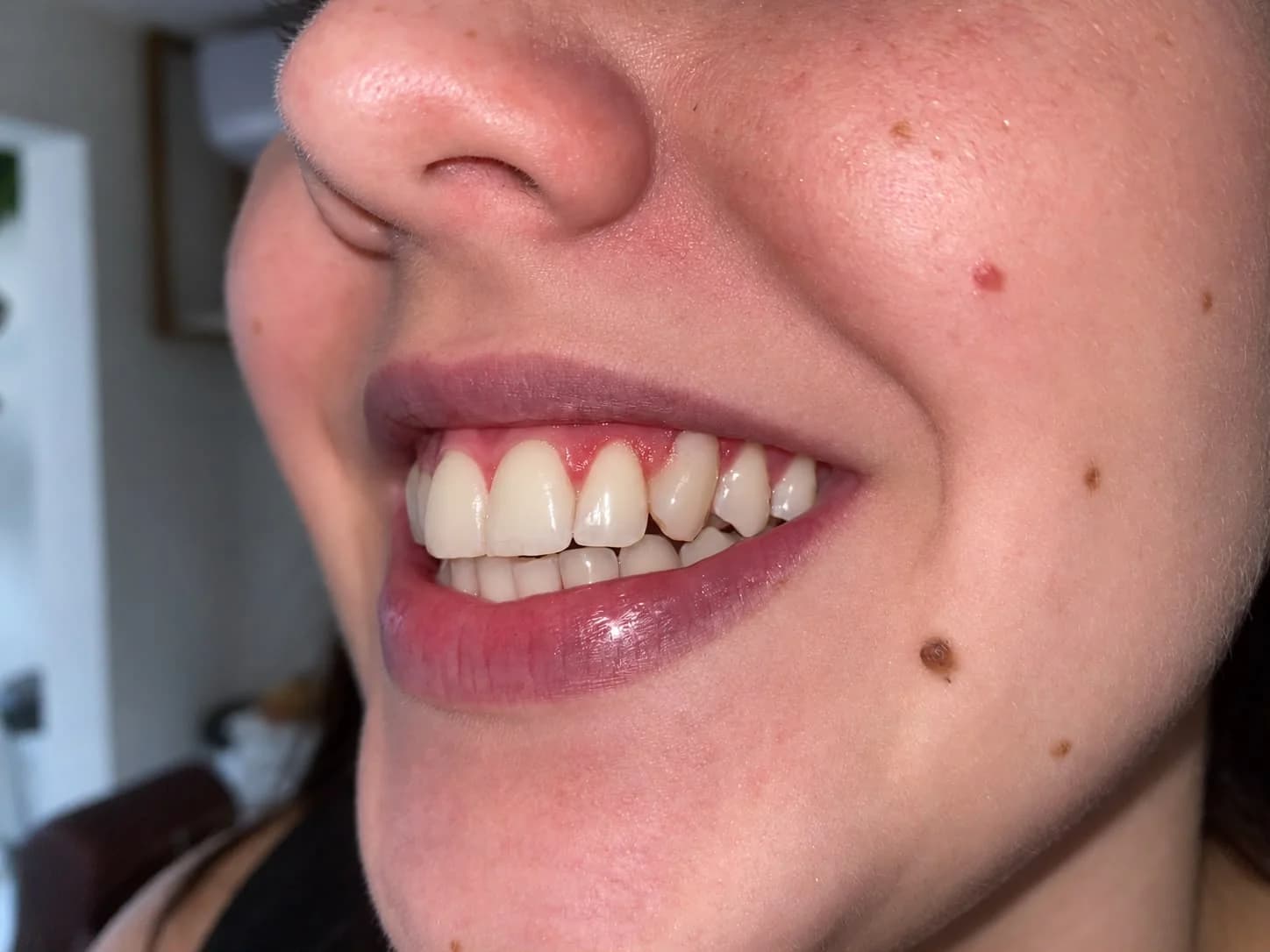 Sorriso de paciente durante um cuidado odontológico preventivo